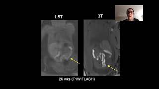 Topics in Fetal Medicine MR Fetal Imaging [upl. by Dedric]