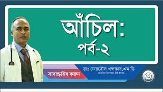 আচিল২ চিকিৎসা [upl. by Anilat]