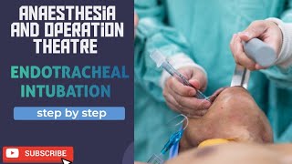 endotracheal intubation [upl. by Moorefield531]