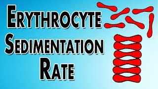 Erythrocyte Sedimentation Rate [upl. by Balas753]