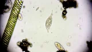 Amphileptus meleagris  Ciliate  Wimpertierchen  Hemiophrys meleagris  microorganisms microscope [upl. by Rabassa]