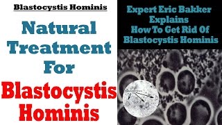 Blastocystis Hominis Treatment Natural Treatment For Blastocystis Hominis  Ask Eric Bakker [upl. by Honig]