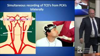 Head Turn Syncope Rotational Vertebrobasilar Ischemia by David Newell MD [upl. by Vargas]