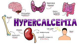 An Approach to Hypercalcemia  Causes Calcium Homeostasis Mechanisms amp Signs and Symptoms Mnemonic [upl. by Harte]