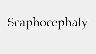 How to Pronounce Scaphocephaly [upl. by Erdah875]