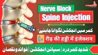 Nerve Block Injection  Good or Bad  UrduHindi [upl. by Gninnahc382]