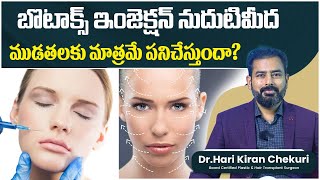 Botox Treatment for Face Telugu  Botox Myths vs Facts What You Really Need to Know  ReDefine [upl. by Beulah]