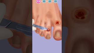 ASMR Relaxing Foot Cleaning amp Treatment  Ultimate Pampering Session asmr [upl. by Chloras]