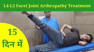 L4L5 Facet Joint Arthropathy Treatment in 15 Days  Slip Disc treatment by dr mukesh sharma [upl. by Arther]