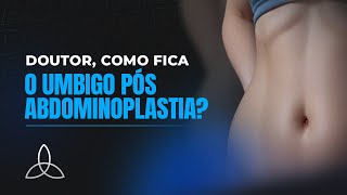 O Umbigo Pós Abdominoplastia  Dr Antônio Marcos [upl. by Akila]