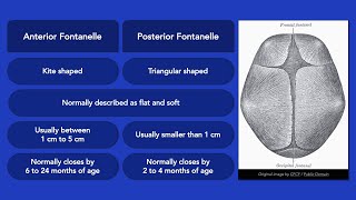 Fontanelles [upl. by Ahsiket]