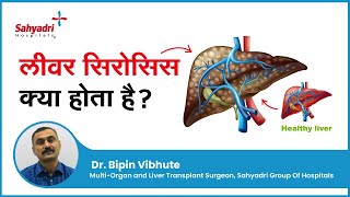 लीवर सिरोसिस क्या होता है  Liver Cirrhosis In Hindi  Dr Bipin Vibhute Sahyadri Hospitals Pune [upl. by Viridis43]