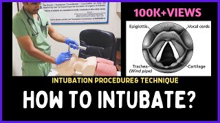 HOW TO INTUBATE INTUBATION PROCEDURE amp TECHNIQUE [upl. by Drhacir]