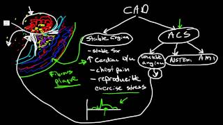 Pathophysiology of Coronary Artery Disease [upl. by Elacim]