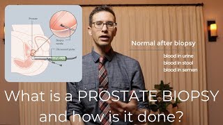 Prostate biopsy procedure explained by urologist [upl. by O'Doneven]