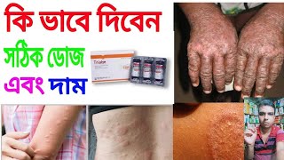 trialon ইনজেকশন এর কাজ কি full review Bangla তীব্র কাশি অ্যাজমা এলার্জি রোগে। [upl. by Nolita]