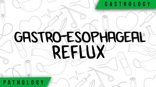 GastroEsophageal Reflux  Physiopathology Symptoms Complications Treatment [upl. by Yetti]