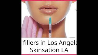 Lip fillers in Los Angeles  Skinsation LA [upl. by Obadias]