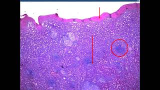 Sarcoidosis Rhino Actinomycosis Leprosy FB 2024  jars and slides [upl. by Namrak718]