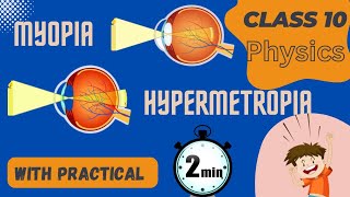 Myopia amp Hypermetropia II Reason II Correction  Practical [upl. by Nahshunn]