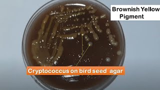 Cryptococcus neoformans colony morphology on Bird seed agar [upl. by Halfdan]