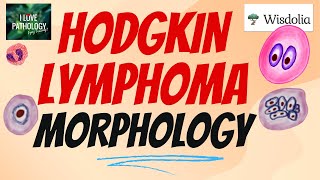 HODGKIN LYMPHOMA  Morphology ReedSternberg Cell Variants [upl. by Desmond380]