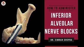 Inferior Alveolar Nerve Block Technique l Mandibular Nerve Block l Nerve Block Technique [upl. by Ardnasal247]