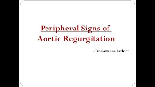 Peripheral signs of Aortic Regurgitation Dr Sameena Farheen [upl. by Borman835]