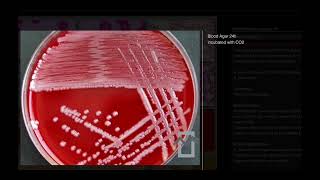 Acinetobacter baumannii  Microbiology [upl. by Spillihp]