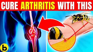 Bee Sting Venom May Actually Cure Arthritis [upl. by Jodoin206]