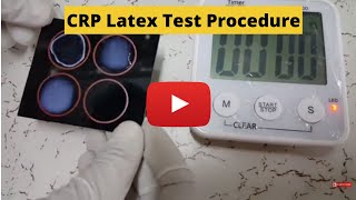 CReactive Protein Test CRP Latex Test Procedure [upl. by Innavoij]