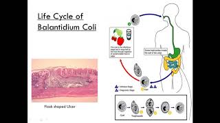 Balantidium Coli Class Ciliate Parasitology [upl. by Gage]