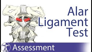 Alar Ligament Stress Test  Upper Cervical Spine Instability [upl. by Anig]