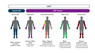 Optimizing Outcomes in CIDP Honing Diagnostic Accuracy Personalizing Treatment Plans [upl. by Talya]