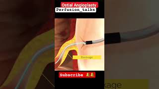 CORONARY GRAFTSOSTIAL GRAFT CARDIAC SHUNT OSTIAL SHUNT HEART DISEASE [upl. by Attekal]