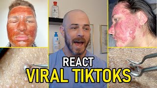 Insane Transformation Reactions  Pimple Pop amp Chemical Peel [upl. by Oneida]