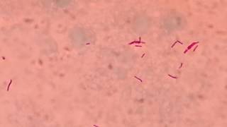 AFB stained slide of Mycobacterium tuberculosis like bacteria on counter stain Malachite green [upl. by Amlas]