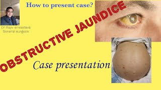 Obstructive jaundicecase presentation [upl. by Mccullough171]