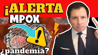 ALERTA ⚠️ ¿NUEVA PANDEMIA AMENAZA AL MUNDO ¿VIRUELA DEL MONO [upl. by Anaujahs]