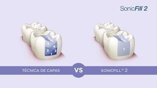 Técnica de capas y técnica bulk fill ¿qué sucede cuando se comparan ES VIDEO [upl. by Nitsyrk]