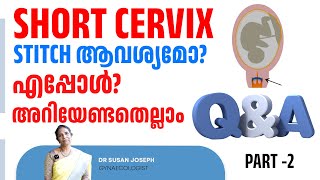 Short cervix  എപ്പോഴും stitch ആവശ്യമുണ്ടോ [upl. by Boaten380]