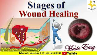 Stages of WOUND HEALING  NURSING  Made Easy [upl. by Brighton]