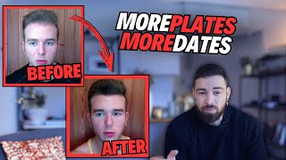 MorePlatesMoreDates Hair Loss History He quit Ru58841 and had massive hair loss [upl. by Elsilrac]