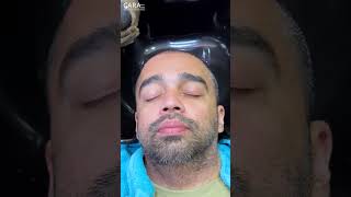 First Headwash After Hair Transplant at Cara Clinic 2024 [upl. by Anahpos799]