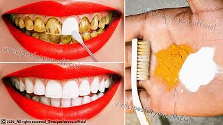 Natural mixtures for yellow teeth whitening at home in 2 minutes without a dentist a proven method💯 [upl. by Nawoj]