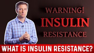 What Is Insulin Resistance – Dr Berg [upl. by Eldoria]