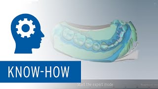 Abdruck Scan Tutorial mit Ceramill Map Scanner [upl. by Paymar440]