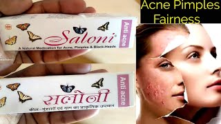 Saloni anti acne cream use or side effects in hindi [upl. by Martyn405]