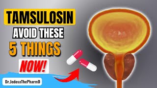 Taking Tamsulosin 5 Things You Must Avoid If You Are Taking Tamsulosin [upl. by Brok]