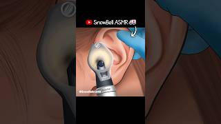 ASMR  Ear wax Removal amp Ear Cleaning Animation shorts satisfying asmr animation earcleaning [upl. by Attoynek]